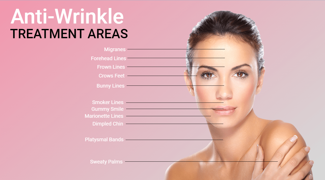 Swiss Aesthetics Anti-wrinkle treatment areas